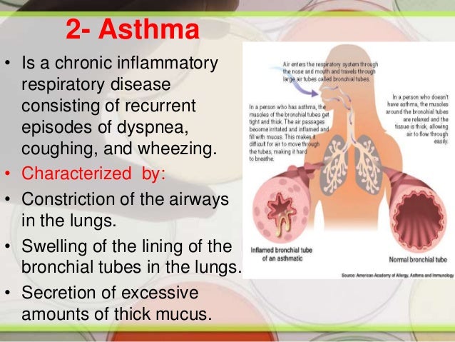 asthma prevention asthma causes